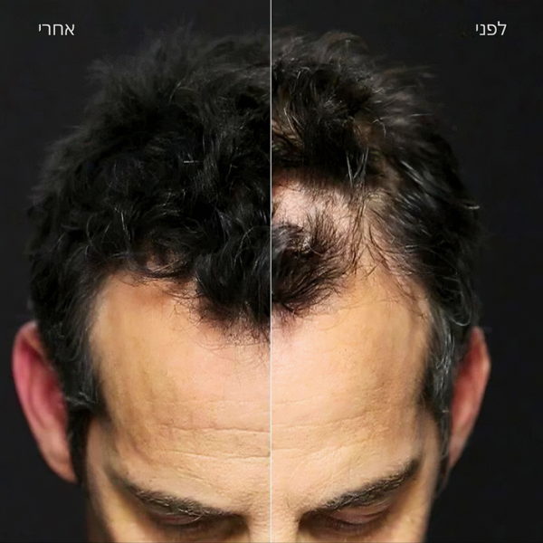 סיבי שיער - סיבי שיער טופיק 3 גרם מאת טופיק TOPPIK | | אידיאלית ל- טופיק סיבי שיער | מושלמת ל- {{ product_use_case }}